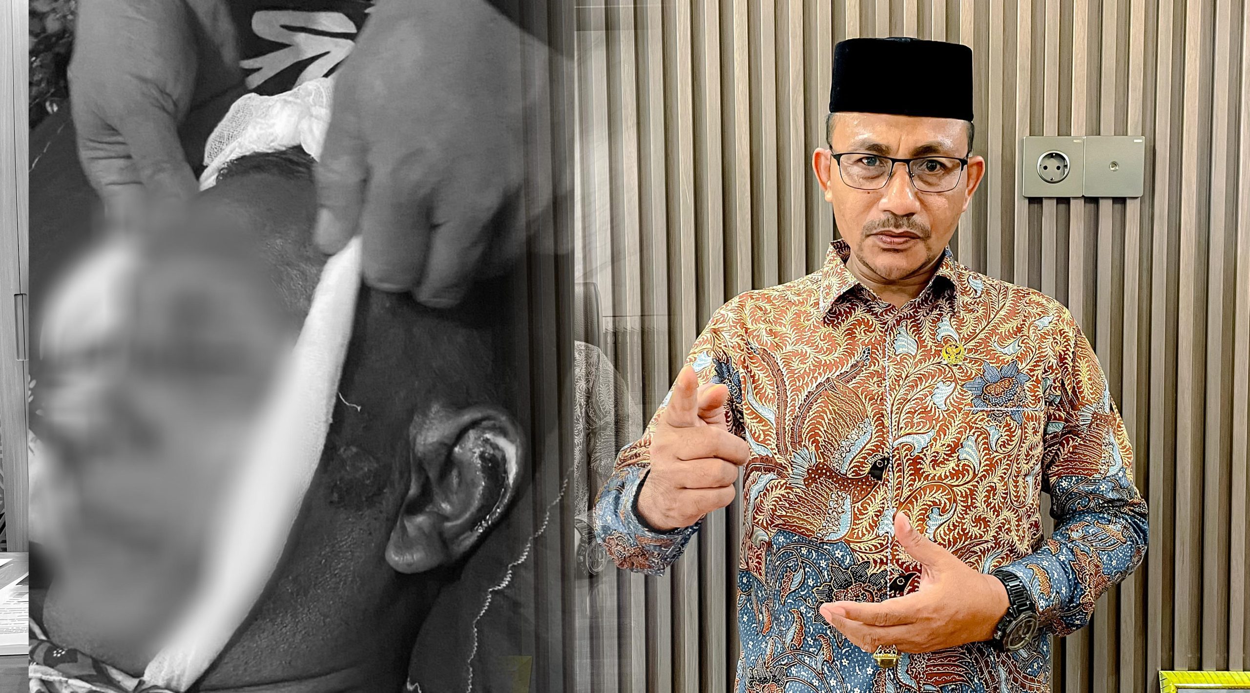 Warga Aceh Utara Meninggal Dunia diduga akibat Dianiaya Oknum Polisi, Haji Uma Minta Polda Aceh Tangani Serius