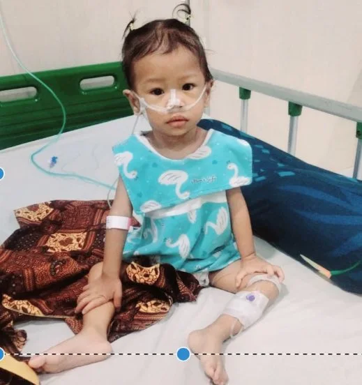 Di Usia 2 Tahun, Arisha Sudah Berjuang Bertahan Hidup : Melawan Kebocoran Jantung yang Perlahan Merusak Paru-Parunya
